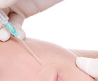 Microsclerotherapy, hampshire